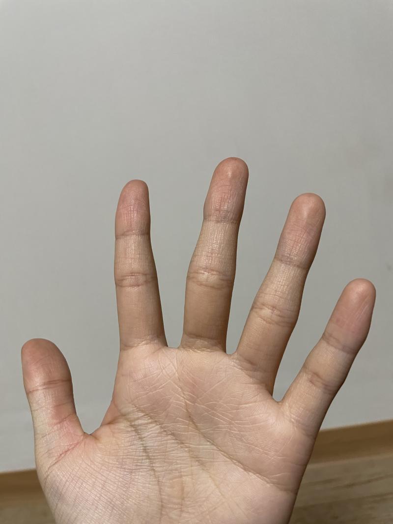 믿기진 않겠지만 꽃다운 나이의 여학생 손이란다.. 진짜 손 예쁜애들 너무 부러워..