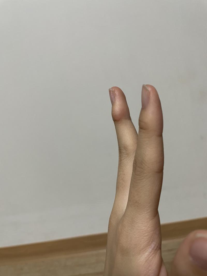 믿기진 않겠지만 꽃다운 나이의 여학생 손이란다.. 진짜 손 예쁜애들 너무 부러워..