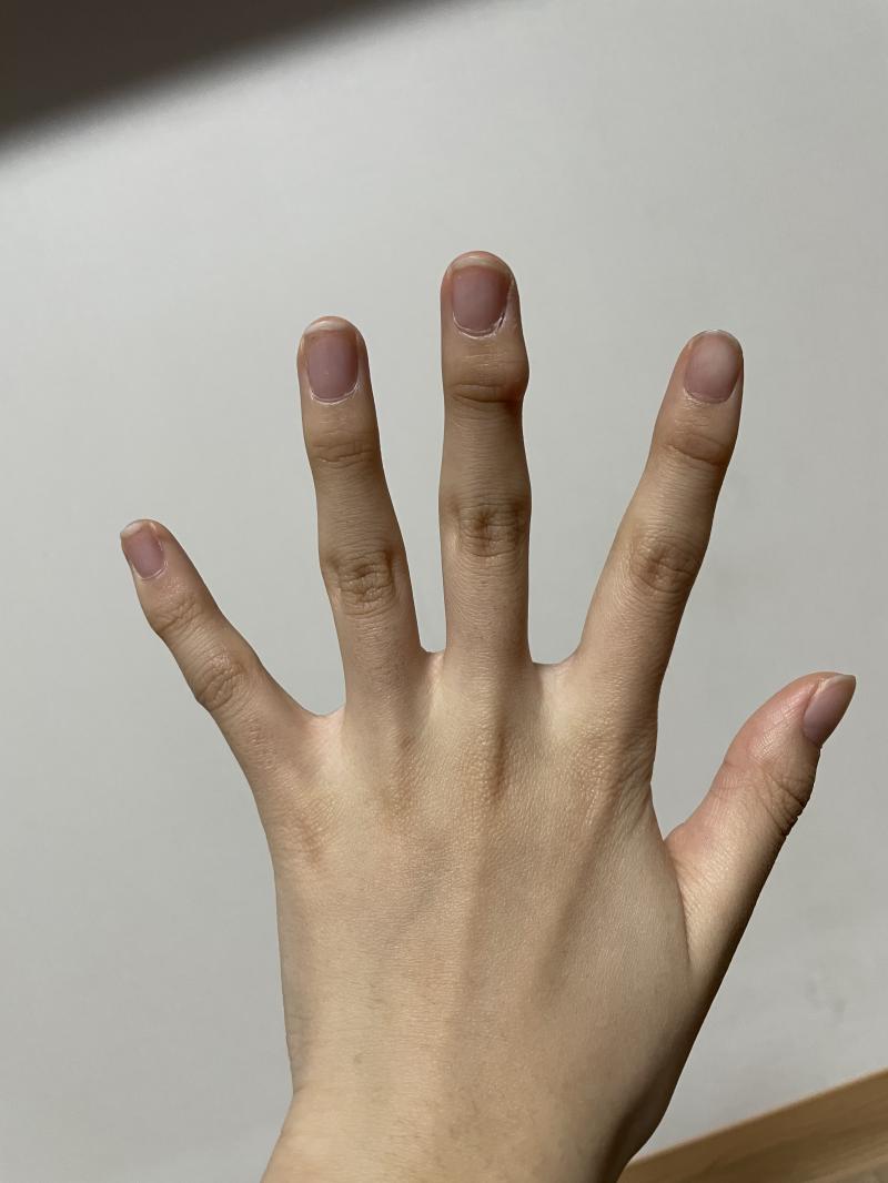 믿기진 않겠지만 꽃다운 나이의 여학생 손이란다.. 진짜 손 예쁜애들 너무 부러워..