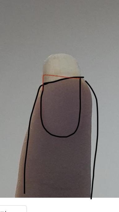 빨간색 부분 손톱 바디를 채워보는건 어때?? 손톱은 윗 레더 말대로 한번 리셋하는 겸 짧게 자르고.. 손톱 너무 긴것도 바디가 안자란다고 하더라