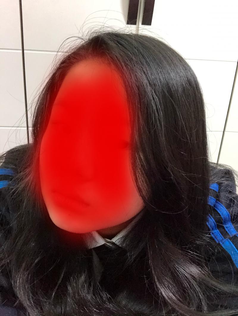 항