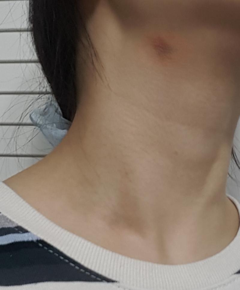 이개머ㅜ너...