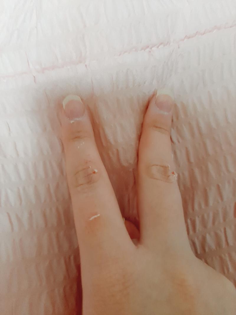너흰 절대로 아이스크림 꽁꽁언 거 뿌신다고 나처럼 하지 마...