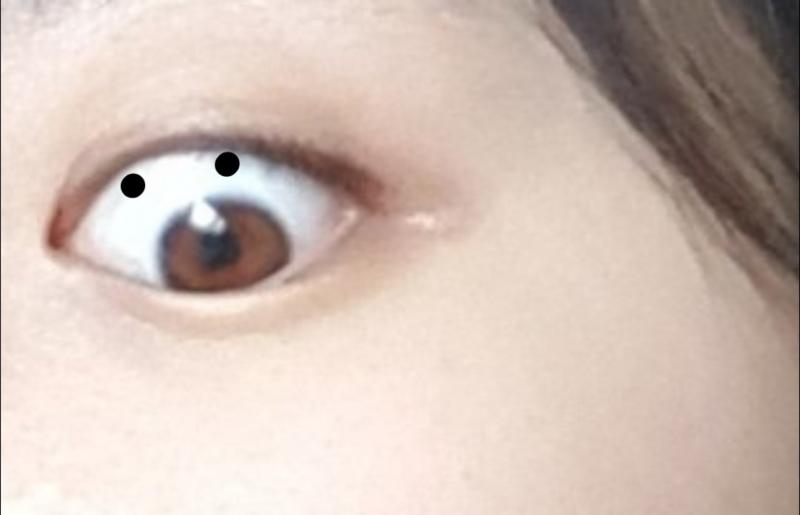 뿅