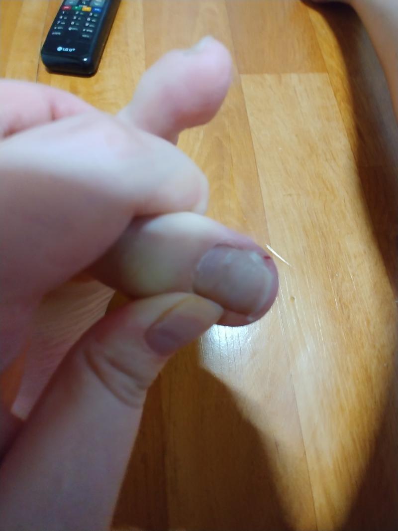 얼마전에도 손톱이 갈라졌었는데 이번에는 문지방 지나다 좀 심하게 갈려져서 자름 ㅠㅜ 우유 많이 마셔야지 ㅠ