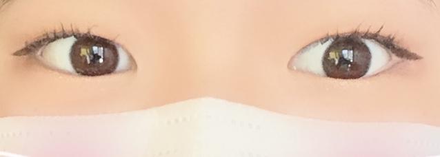 >>8 일단 쌍수 전부터 보여줄게 1은 쌍테 (난 ㄹㅇ 쌍테랑 한 몸이었음) 2는 걍 평소 눈 3은 쌍테 안 붙이고 붓기 좀 빠졌을때