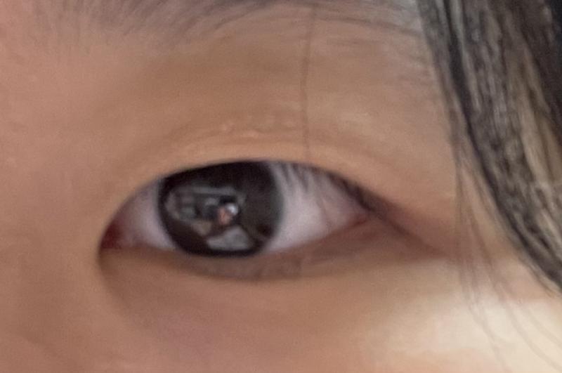 . 반대쪽 눈은 내가 비비는 바람에 충혈되서 못올렸다.. 도와줘ㅜㅜ