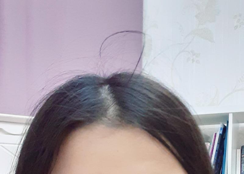 똥폰이라 화질 많이 안 젛아 미안........ 여튼 아침에 일어나면 저 짧은 머리카락이 서있음... 꾹꾹 누르면 어떻게 내려가긴 하는데... 