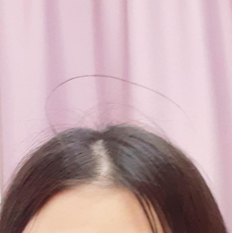 똥폰이라 화질 많이 안 젛아 미안........ 여튼 아침에 일어나면 저 짧은 머리카락이 서있음... 꾹꾹 누르면 어떻게 내려가긴 하는데... 
