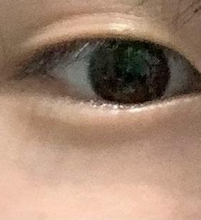 내 눈이야..