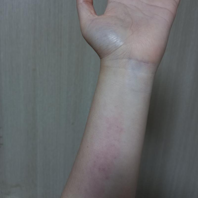 피터질만큼 해보자 오늘은 좀 약했으 할수있따!!!!!