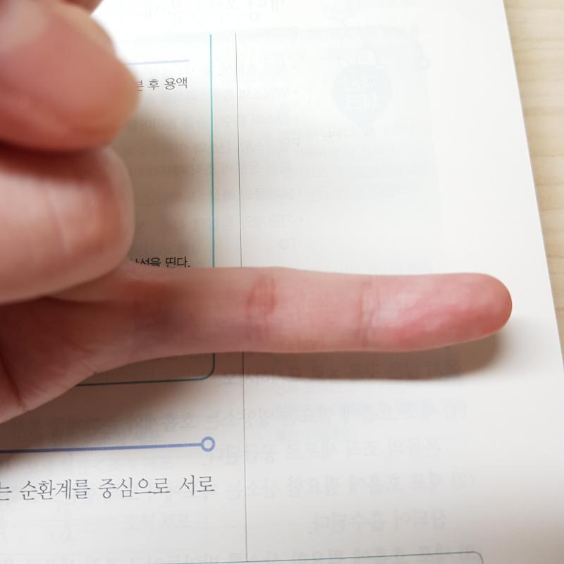 미쳤다 진짜 각각 오른,왼손 새끼손가락인데 이렇게 심할줄은 몰랐어 너무 어릴때부터 피아노 쳐서 더 그런가 너무 휘었다;;;