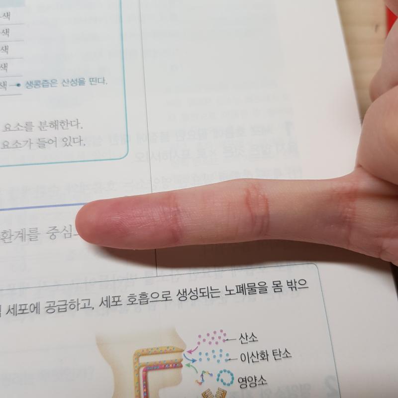 미쳤다 진짜 각각 오른,왼손 새끼손가락인데 이렇게 심할줄은 몰랐어 너무 어릴때부터 피아노 쳐서 더 그런가 너무 휘었다;;;