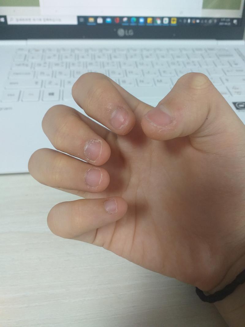 상태 개판이다 증말 매일 아침 손 사진 올릴게