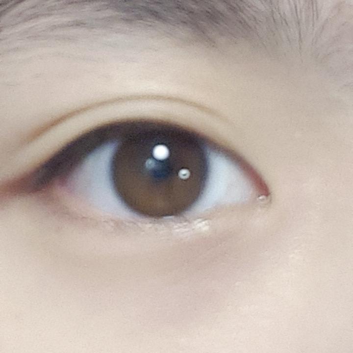 >>19 좀 나아지긴 했는데...여전히 부어있음 ㅋㅋㅋㅋㅋㅋ