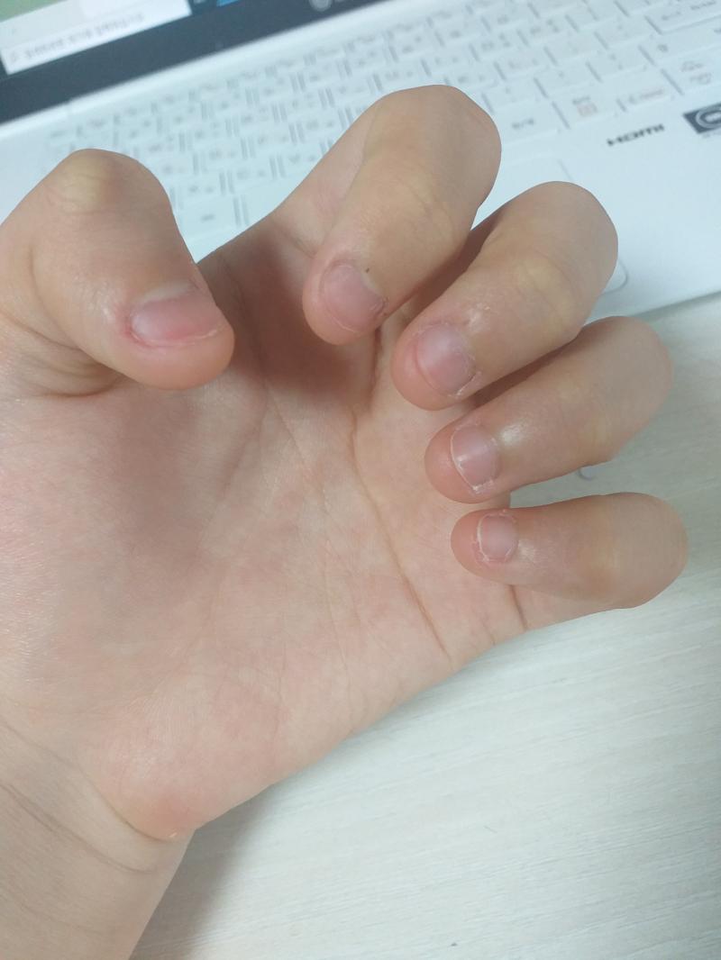 상태 개판이다 증말 매일 아침 손 사진 올릴게