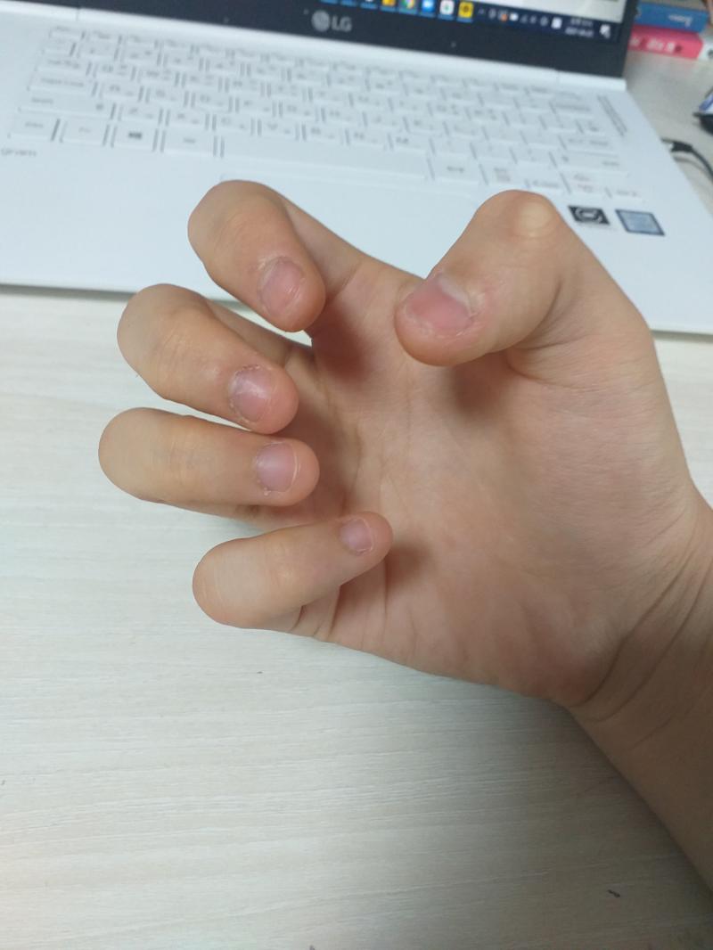 오늘자 손톱