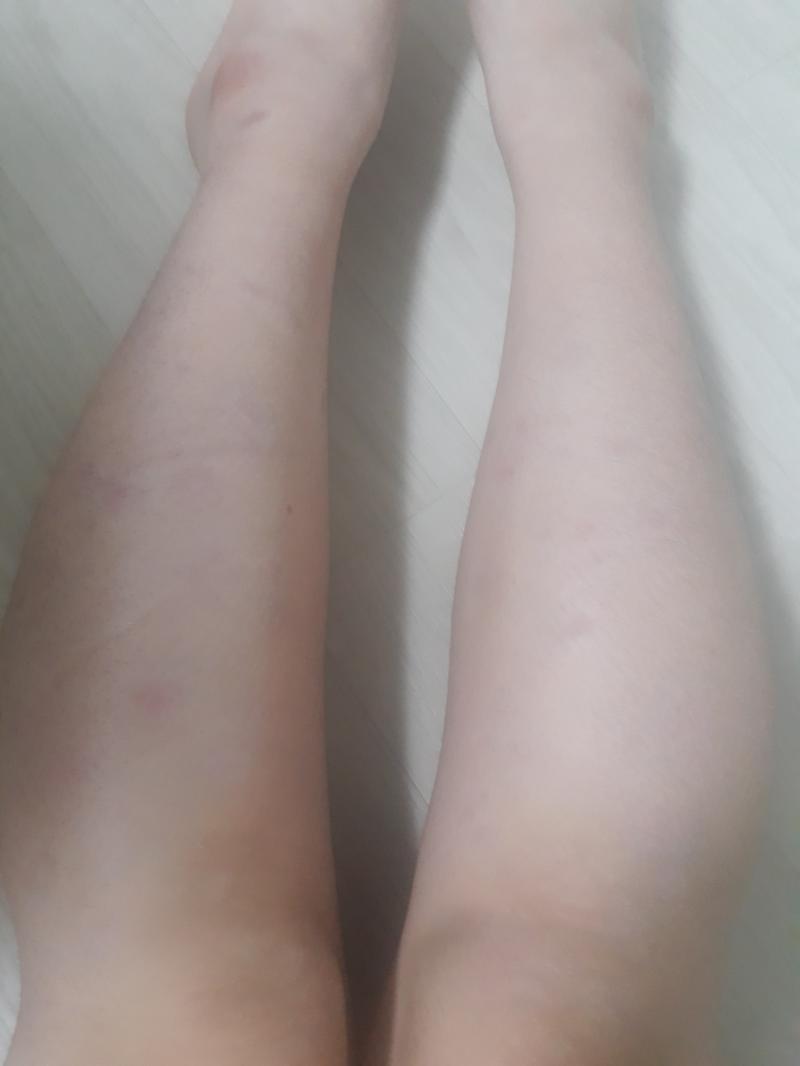 종아리 안쪽은 많~이 좋아졌어 뒤쪽은 더 관리가 필요하구