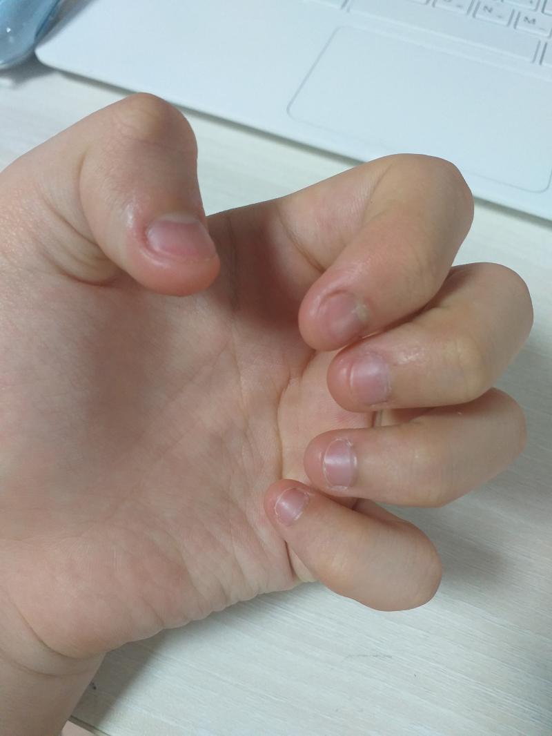 오늘자 손톱