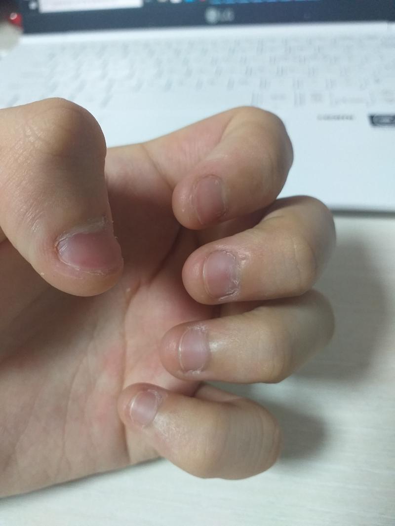 오늘자 손톱