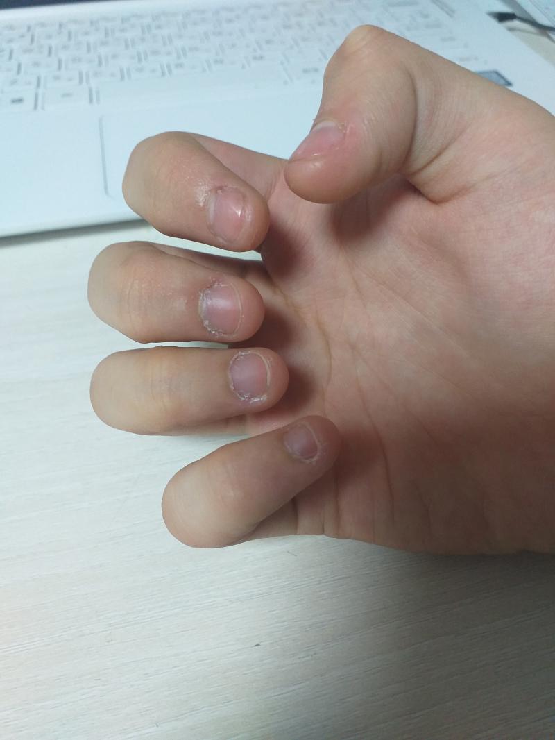 오늘자 손톱