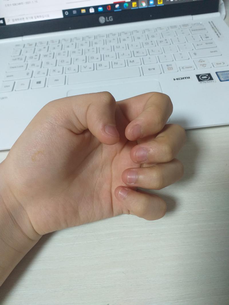 오늘자 손톱
