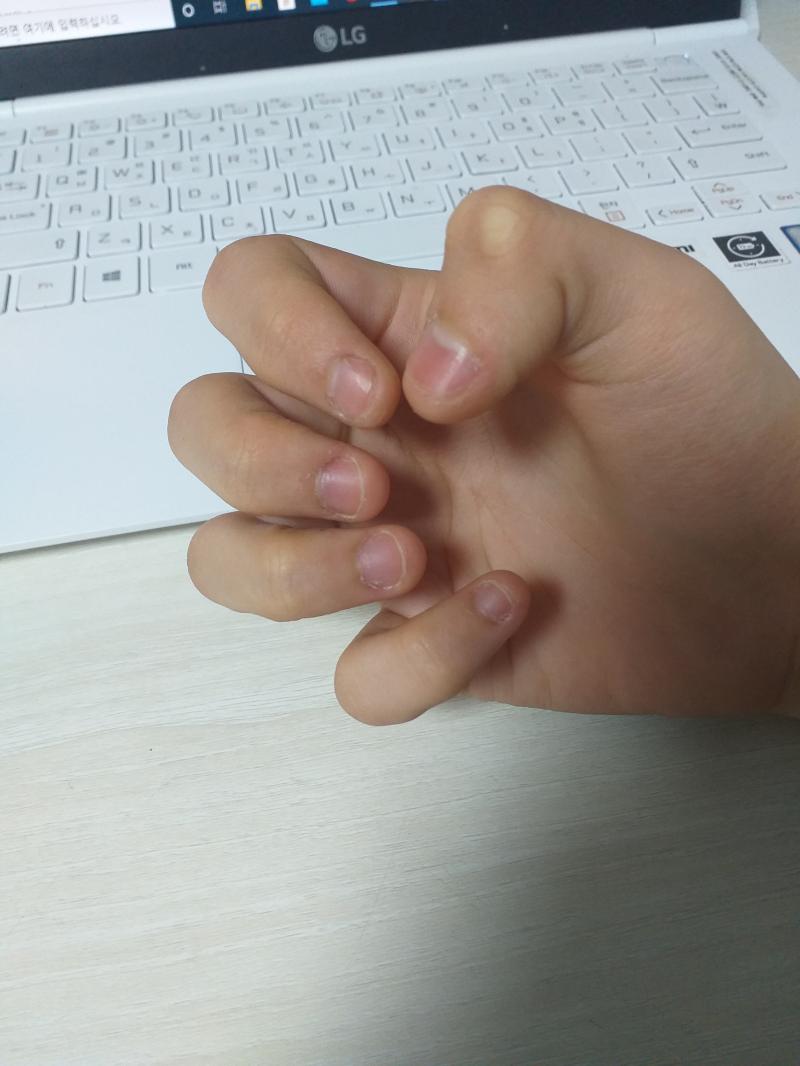 오늘자 손톱