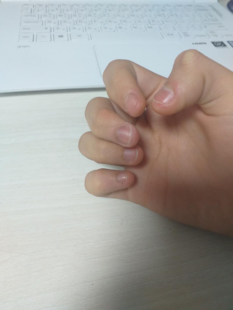 오늘자 손톱, 운동스