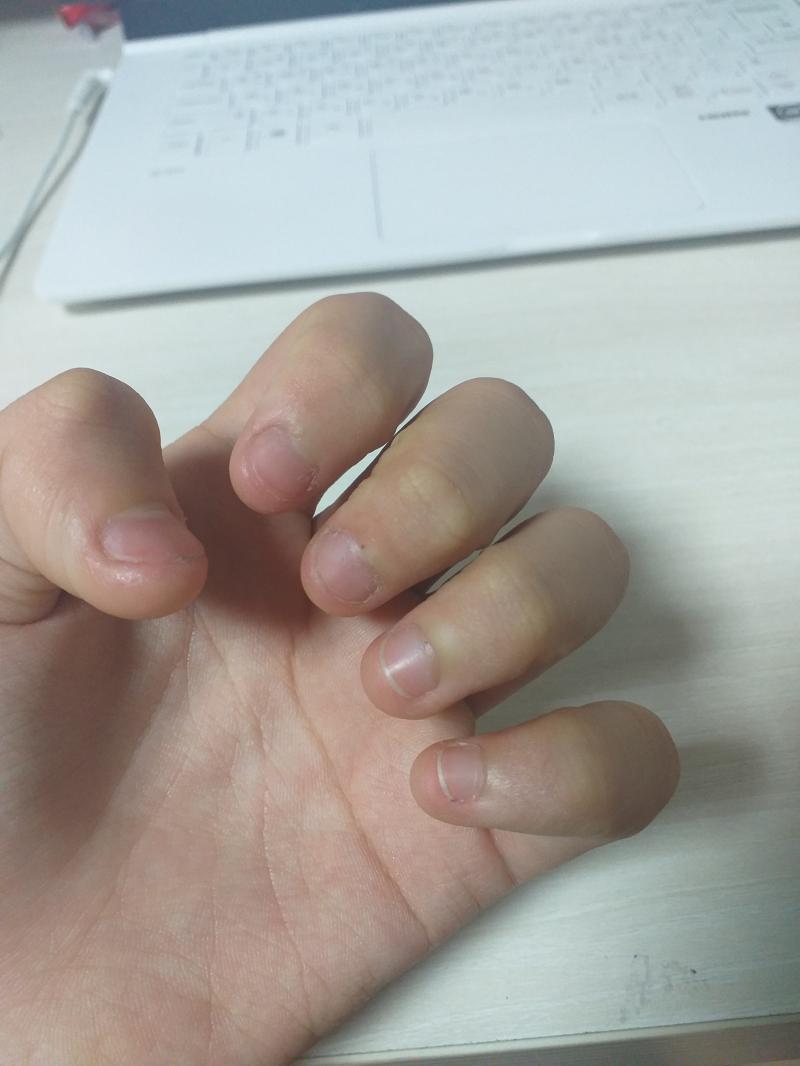 오늘자 손톱, 운동스