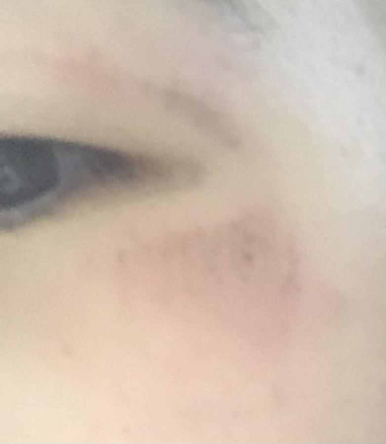 보이니 이 영광의 상처가..