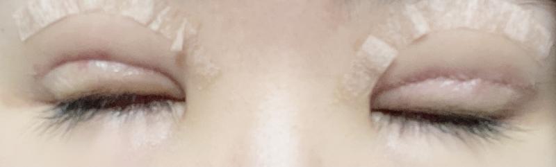 >>14 칭찬은 스레주를 춤추게 합니다 !!! 보자마자 기분이 좋아지네 고마워ㅎㅎ 수술한 당일부터 열심히 팥물을 삶고 있는데 나는 팥물 먹고 동