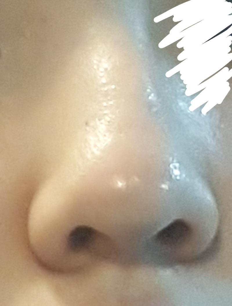 아 참고로 두번째 사진 코 왼쪽에 까만건 점이야 블렉헤드 아니구!!