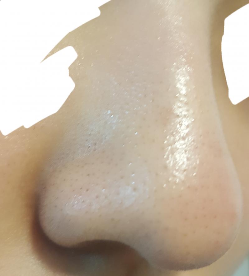아 참고로 두번째 사진 코 왼쪽에 까만건 점이야 블렉헤드 아니구!!