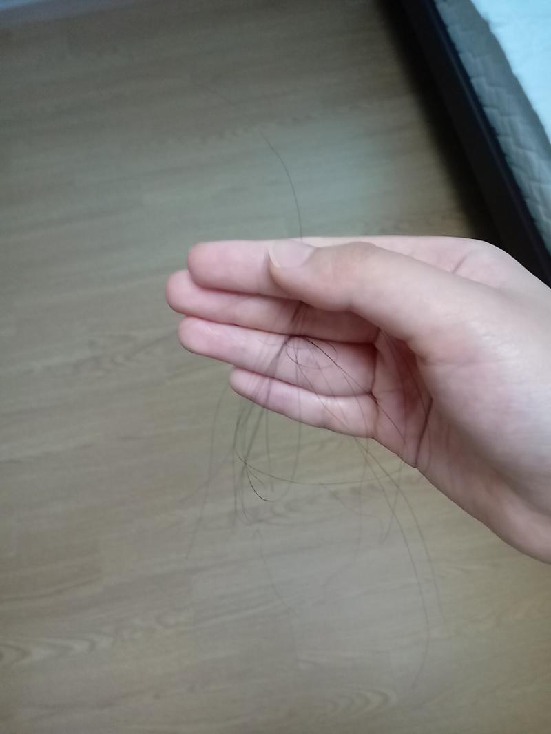 ㅅㅂ 두대 맞았는데ㅜ머리 한번 쓸었더니 ㅈㄴ많이 빠지네