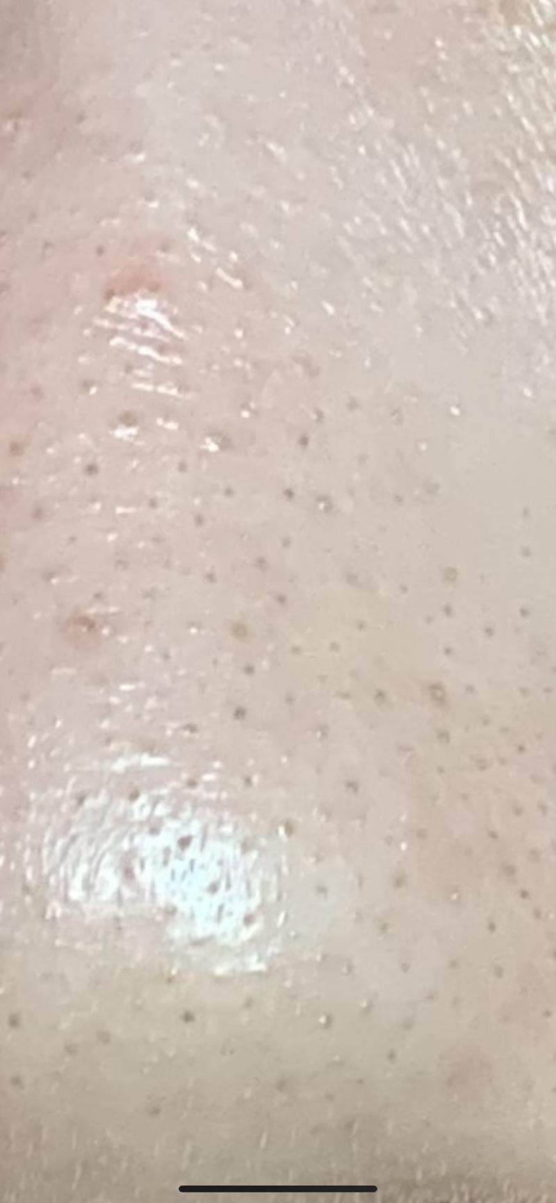 두번째 사진은 내 딸기코야..이거 어캐하냐 ㄹㅇ