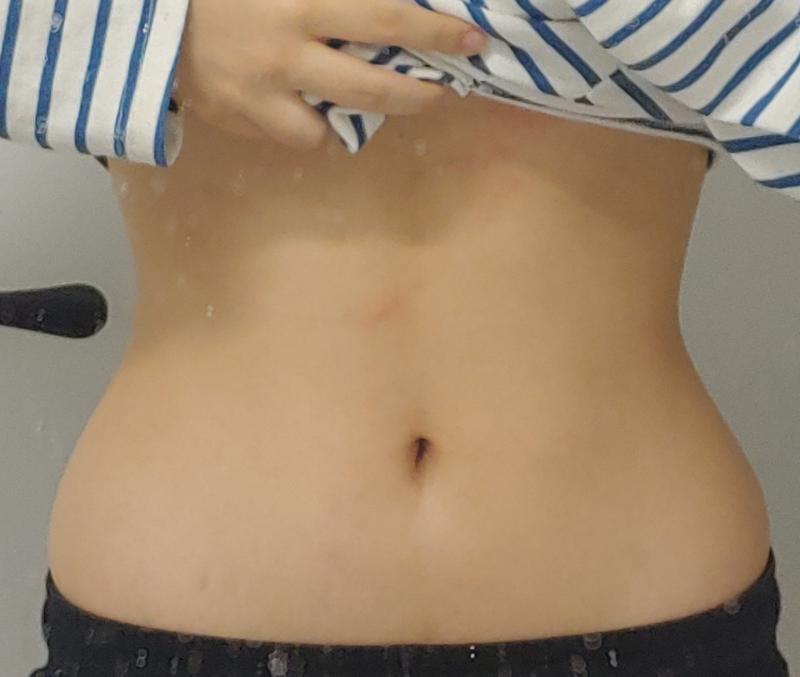 운동 32일차!!! 오늘도 어제랑 같은운동함 저거 한번 2주동안 해볼려고 아 저 배에있는 빨간거는 내가 배 긁는게 습관이라 긁어서저럼