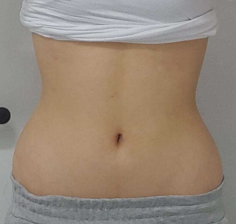 운동 36일차!! 이게 어제건데 찍어놓고 올리는고 까먹었어 ㅋㅋㅋㅋ그 옆구리 여자분꺼 효과별로 없는것같아서 땅끄부부분 7분짜리 운동으로 갈아탔엉