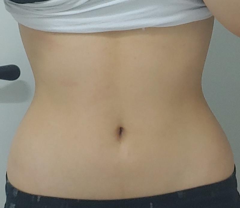운동 37일차! 아 나 오늘부터 다시 달린다