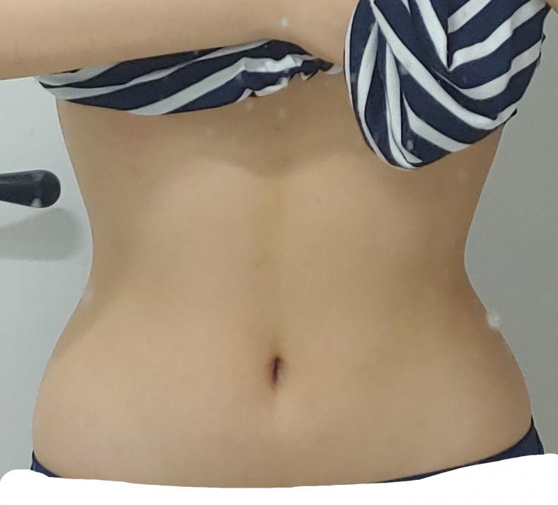 티파니 41일차!! 먹을걸 못줄여서 효과가 안보임