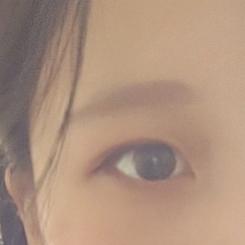ㅗ 설명하기 어려워서 사진 첨부해줄게 이렇게 생겼어! ㅜ 못먹는 음식있어?? 싫어하는거 말고 이건 정말 몸이 거부해서 못먹는다 하는거