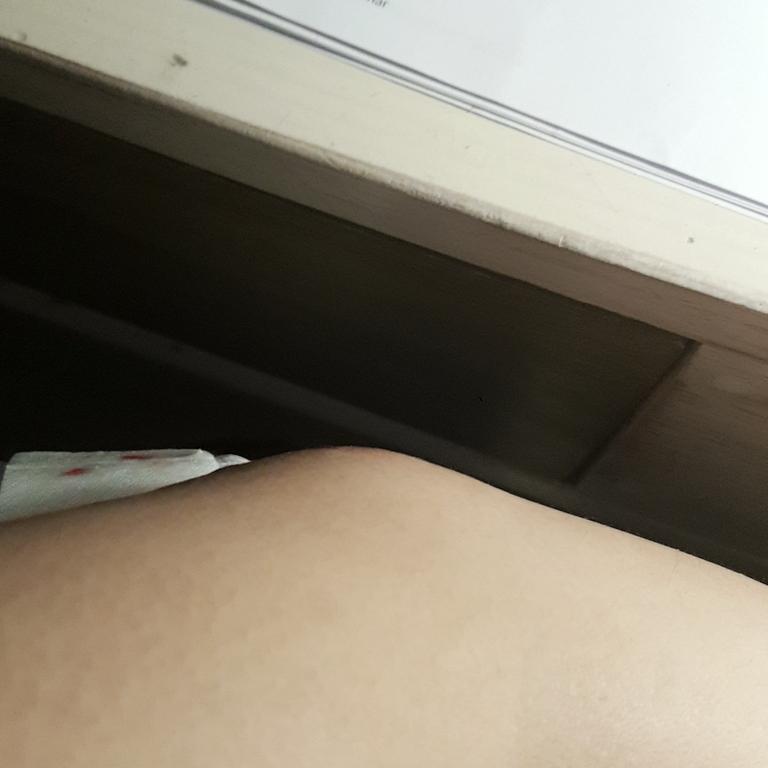 이제 피는 안 나는데 이 정도면 아파해도 더ㅣ늠 거 맞지...?>>25 내일도 이상하면 병원 꼭 갈게 고마워