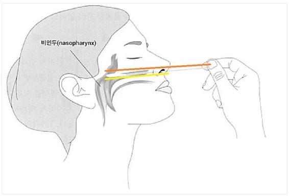 톡이 아직 더 남아 있어서 마스크쓰고 내 방안에서 천천히 읽어 봤어 선생님이 보건소가서 검사를 받으라고 하시더라고... 내가 독감검사 할때부터 
