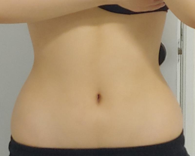 안녕 침구들 오즘 시험공부랑 이것저것 때매 자꾸 못와서ㅠㅠㅠㅠㅠㅠㅠ요즘 다이어트중이야! 피부 여드름도 거의 다 가라앉았어! 근황올릴게! 오늘 올