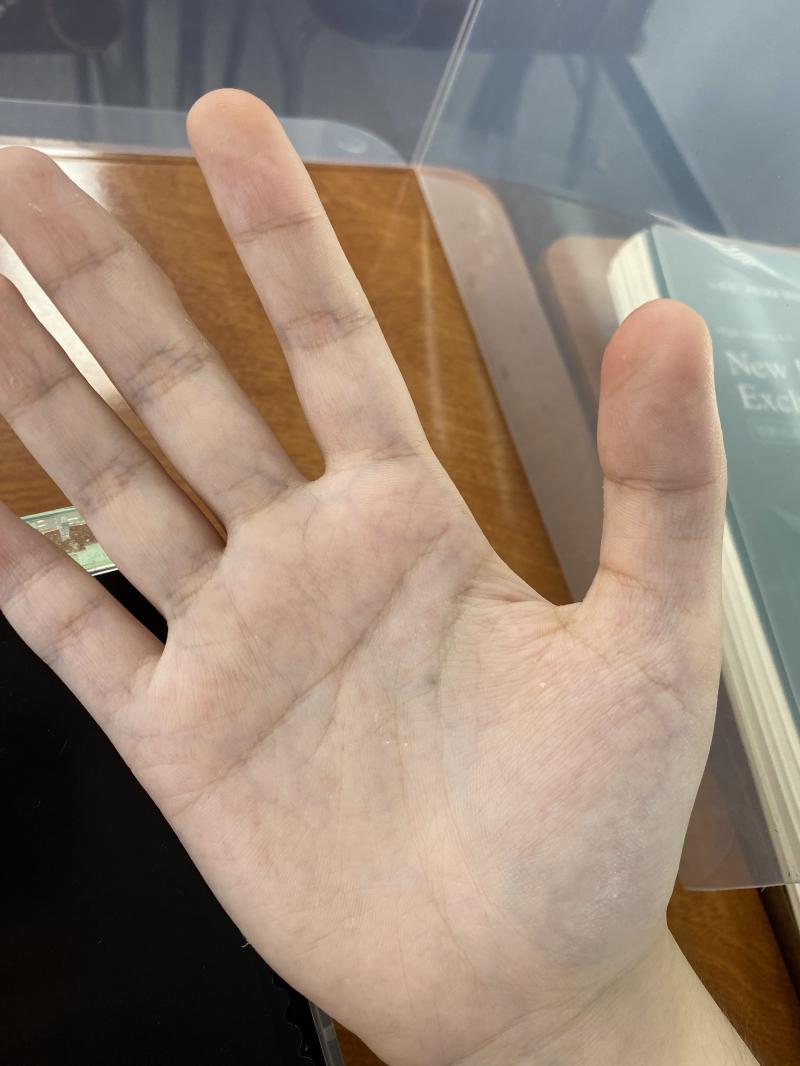 >>402 난 아무 이상없어도 이정도야