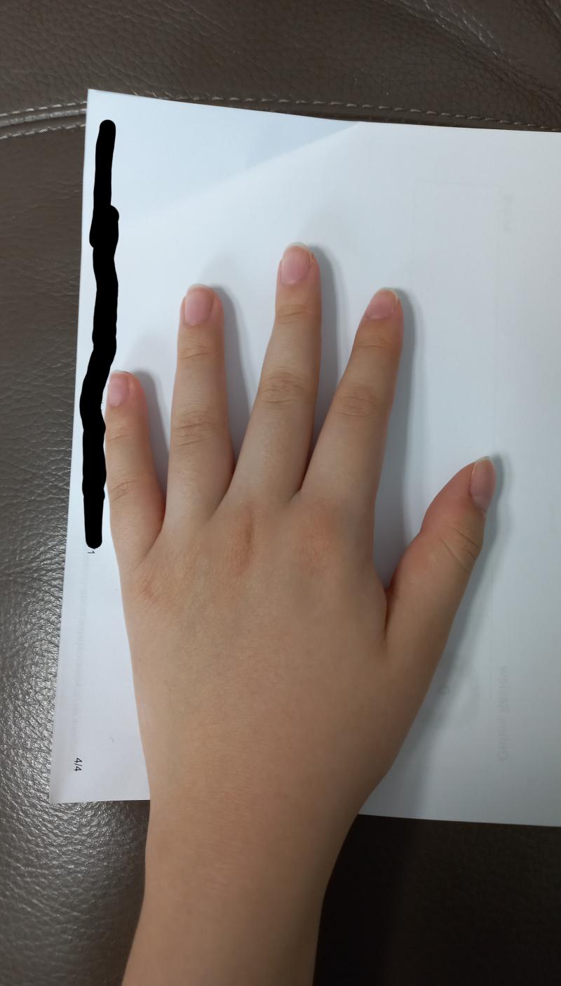 >>56 헐 뭐야 2번째사진이랑 좀 비슷한듯 여자인데 이정도야 작든 크든 손 예쁜애들이 젤 부러움ㅠㅠ아빠가 크림빵손이래ㅠ