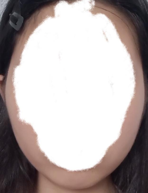 혹시 몸무게 자랑글로 보일까봐 내 절박함을 보여주기 위해서 살찌기 전 후 얼굴형 사진 보여줄게 살찐것도 있는데 광대뼈가 진짜 림각해