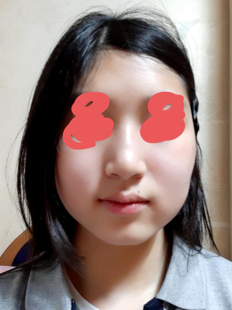 >>2 >>3