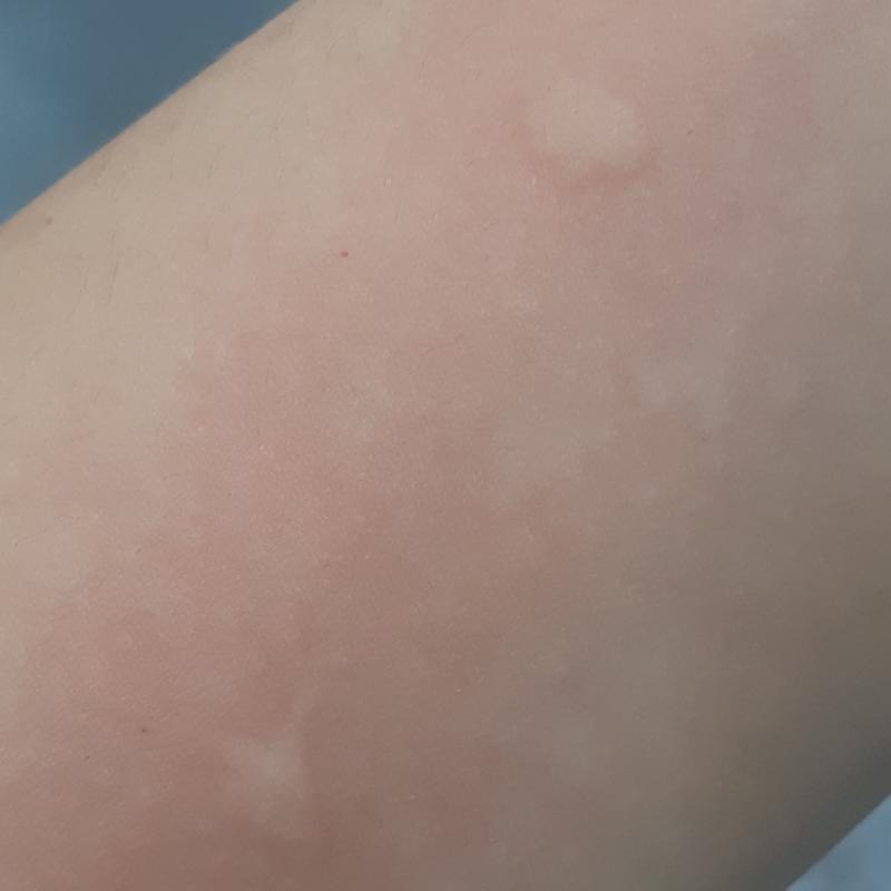 다른 건 몰라도 모기 만큼은 멸종했으면 한다;;