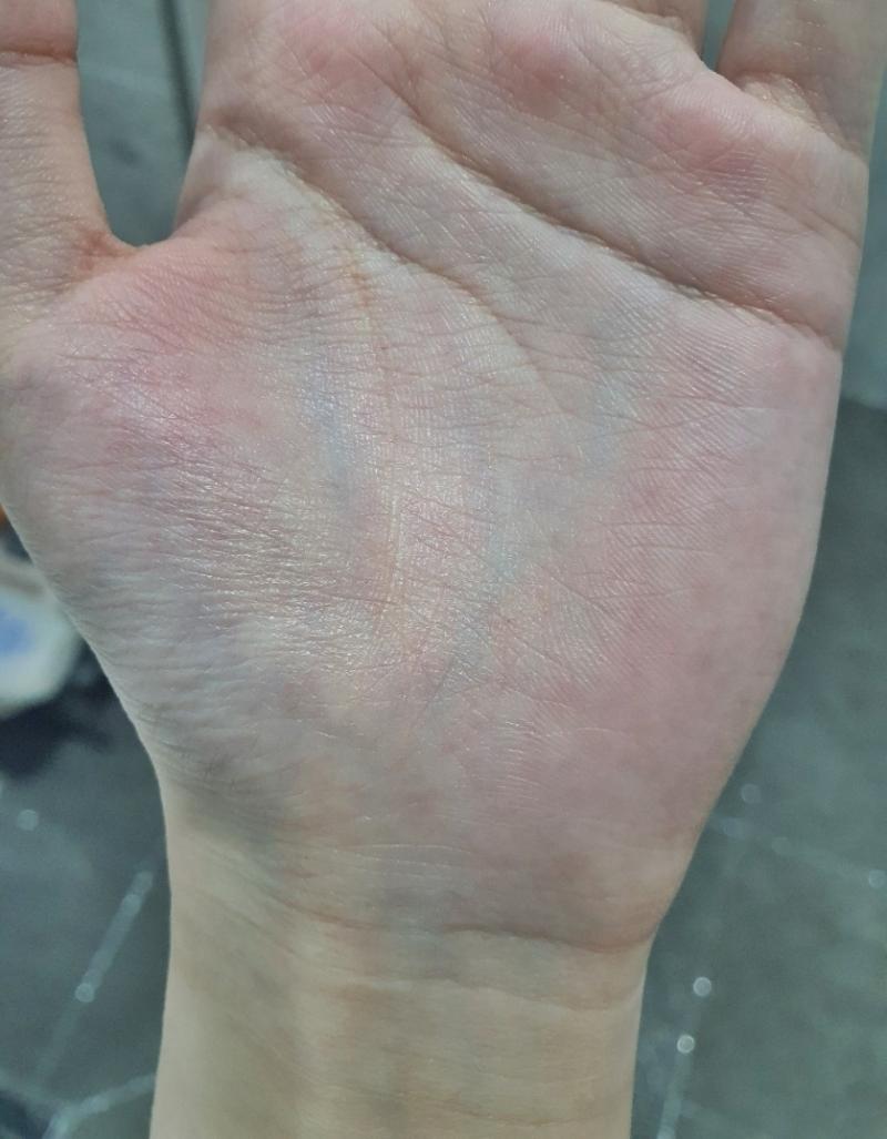 >>404 나 원래 안 보였었는데 갑자기 보이기 시작해서... 그리고 혈관이 날이 갈수록 진해져 ㅋㅋ 원래 안 보이던 사람이 갑자기 이럴 수도