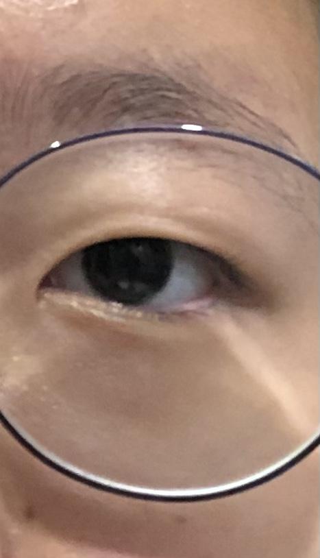 짝짝이 오륹족 눈도..